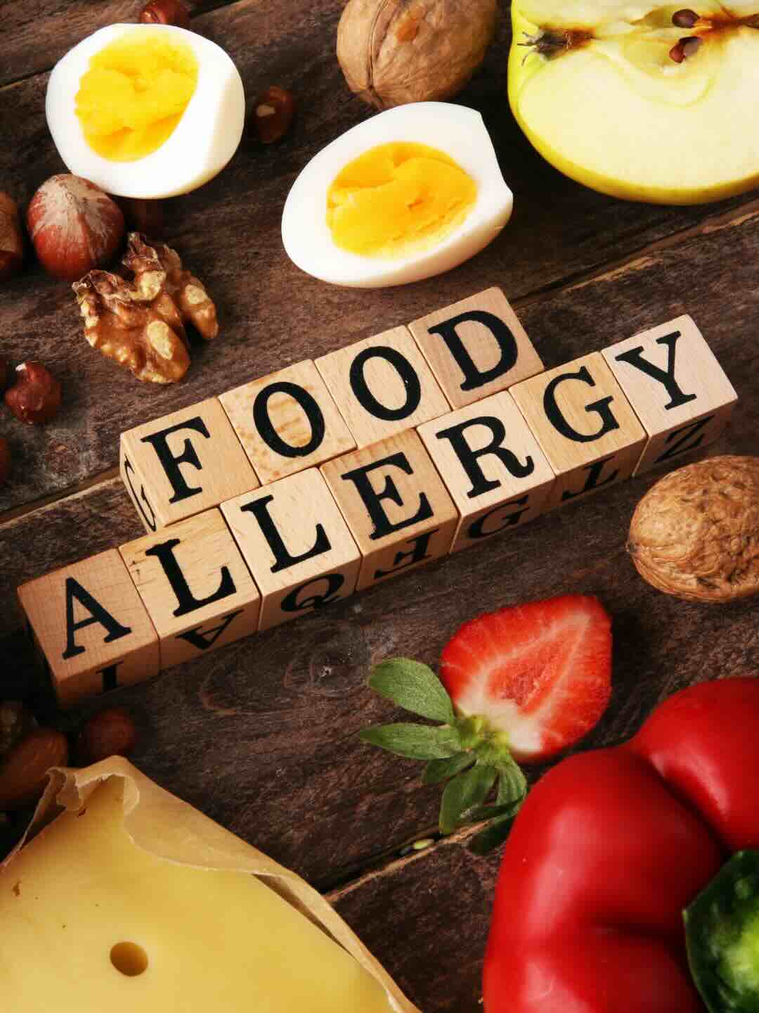 Food Allergies<br />
